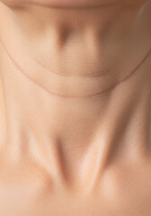 Tech Neck' Horizontal Lines and Crepey Skin