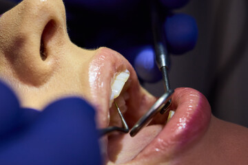 A thorough Dental Checkup is performed with various Tools being used for the procedure