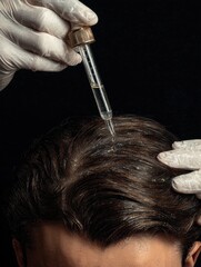 Fototapeta premium a person applying serum to the scalp for hair treatment and health 