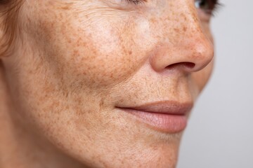 Obraz premium macro close-up of middle-age skin with freckles and mild pigmentation