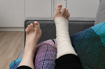 A swollen broken leg lifted up with a compression bandage applied, ankle sprain