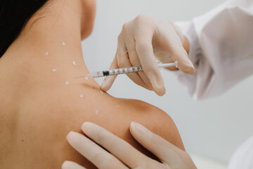 Injection in marked dotes on back for migraine treatment by doctor. Preparation skin marking for...