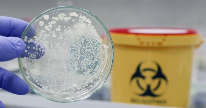 A petri dish with bacterial colonies in a scientist's hand against the background of a biohazard waste container.