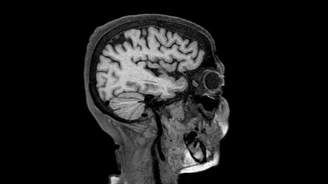 3D MRI brain scan video showcasing detailed anatomical structures and neural pathways. Ideal for neurological analysis, medical education, and advanced imaging research.