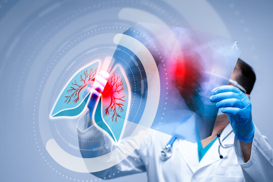 Doctor examines lung X-ray with digital overlay of respiratory system at a medical facility