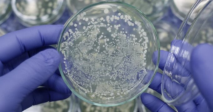 An open petri dish with small colonies of bacteria in a scientist's hand against the background of petri dishes on a work table.
