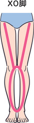 若い女性の脚（XO脚）補助線あり