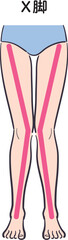 若い女性の脚（X脚）補助線あり