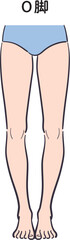若い女性の脚（O脚）