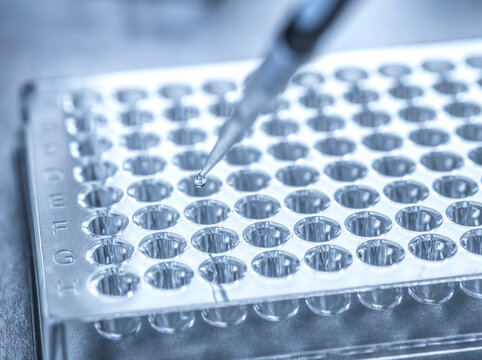 Pipette dispensing liquid into microplate during clinical trial research