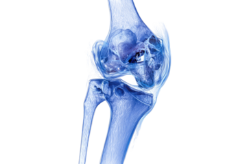 A close-up, side profile of a human knee, rendered in shades of blue