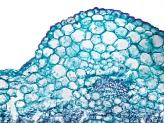 MIkroskopischer Schnitt durch ein Blatt von Jasmin (Jasminium nudiflorum) bei 400facher Vergr&ouml;&szlig;erung