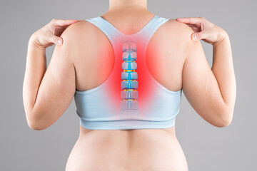 Intervertebral spine hernia, pain between the shoulder blades, woman suffering from backache,...