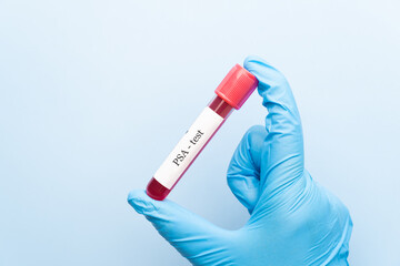 Blood sample tube with PSA test on medical laboratory technologist hands over blue background. A blood test that measures the level of prostate specific antigen to screen for prostate cancer.