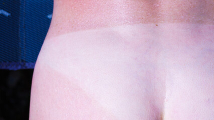 Woman body after taking off bikini with visible tan line from wearing panties