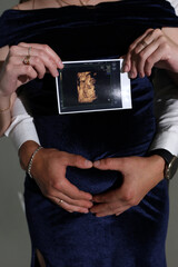 A man hugs his pregnant wife, who is holding an ultrasound image of her unborn baby.