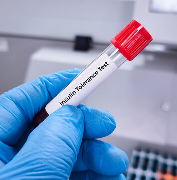 Blood sample for Insulin Tolerance Test(ITT) used to detect insulin resistance. OGTT.
