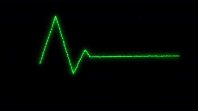 green laser line shockwave heartbeat medical EKG wave cardiogram hospital pulse monitor screen symbol on black background 4K seamless looping animation