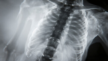 Abstract macro background texture of an x-ray film showing subtle grain and glowing light passing through it