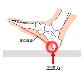 足底筋膜炎　足底筋膜　足底腱膜　足の筋肉