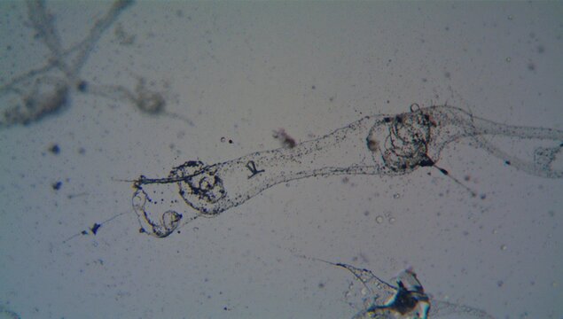 Microscopic View of Trachelomonas Sample from Pond Water, Possibly T. dangeardi or T. armata, at 400x and 10x Magnification