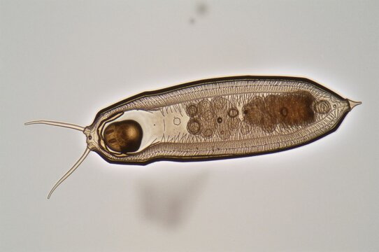 Paramecium caudatum showing oral region, large nucleus, and storage vacuoles