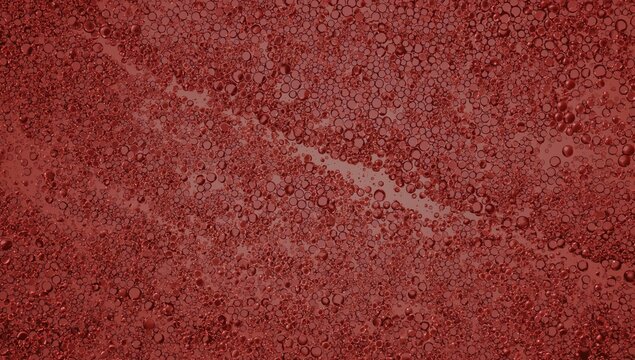 Light microscope view of red blood cells stacked in rouleaux formation associated with multiple myeloma.