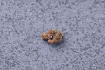 Oxalate stone. Medicine, urology. Macro photo of a kidney stone. Renal colic. 5 mm oxalate stone. Kidney health. Urology, visual aid.