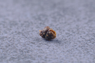 Oxalate stone. Medicine, urology. Macro photo of a kidney stone. Renal colic. 5 mm oxalate stone. Kidney health. Urology, visual aid.