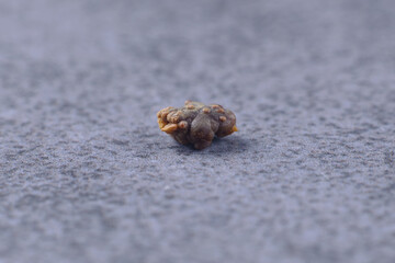 Oxalate stone. Medicine, urology. Macro photo of a kidney stone. Renal colic. 5 mm oxalate stone. Kidney health. Urology, visual aid.