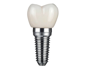 A dental implant featuring a white crown and metal post. Close-up shot on a plain black background