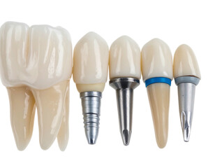 Close-up of five dental implants and crowns, showing various types and sizes against a black background