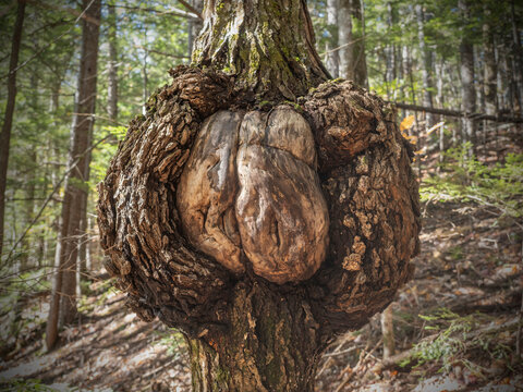 A burl is a large woody, rounded swelling growth usually found on a tree trunk. "Burl wood" is prized for it's unusual grain pattern.