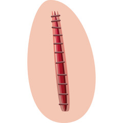Stylized Medical Illustration of a Stitched Wound on Skin with Red and Brown Tones on a Transparent Background
