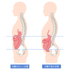 内臓下垂　内臓の位置が下がっている状態