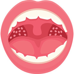 Close Up of Open Mouth Showing Pink Gums White Teeth and Red Tonsils with Small Dots Inside Gargling Area Isolated on Transparent Background