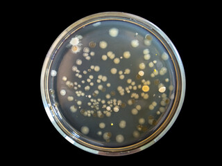 Petri dish with multiple round colonies of bacteria on a black background.