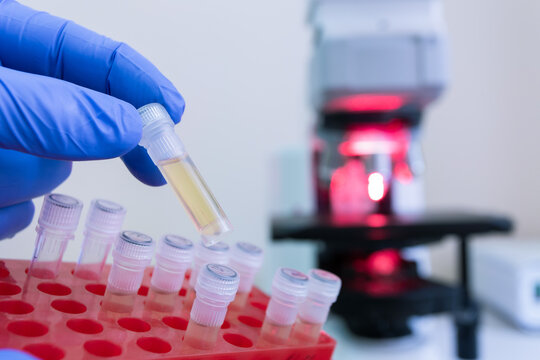 A scientist pulled out a single small test tube containing a test vaccine from a red rack of test tubes, with a microscope blurred in the background.
