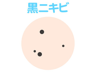 シンプルな黒ニキビのイラスト素材