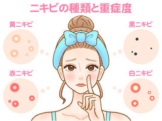 肌荒れに悩むニキビができた顏の大人女性のイラスト素材3