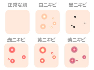 様々なニキビの症例と種類のイラスト素材セット3