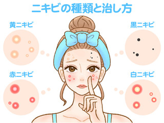 肌荒れに悩むニキビができた顏の大人女性のイラスト素材2