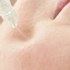 Fototapeta premium Close-up of facial skin hydration with serum on young caucasian female face for skincare treatment.