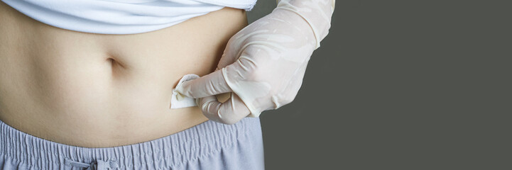 Female adult performing self-care with alcohol swab on abdomen wearing glove for medical hygiene.