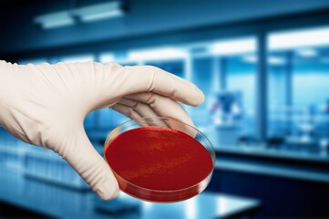 The rise of bacterial infections in Petri dish