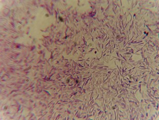 A compound microscope view shows a dense field of rod-shaped (bacillus) bacterial cells clustered on a slide