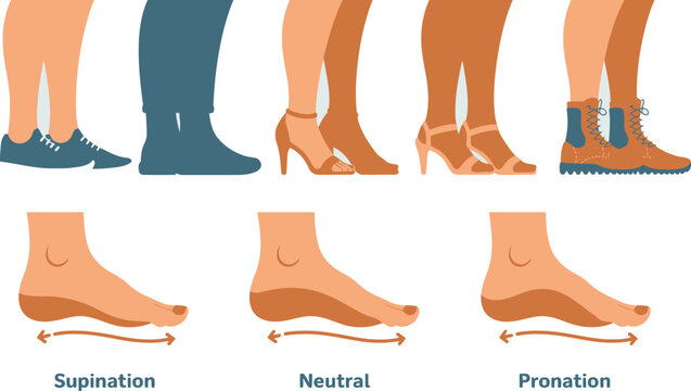 Foot Pronation and Supination Explained with Footwear Examples Flat Shoes, Heels, and Boots Guide