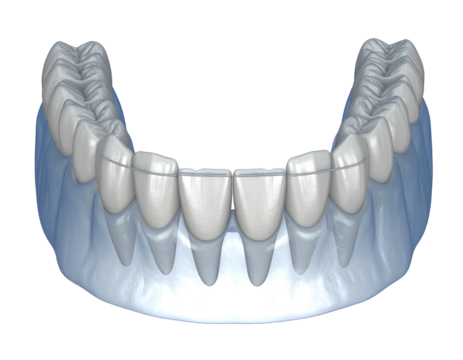 3D render set of bright white teeth within a clear, translucent mold on a black background, facing upwards