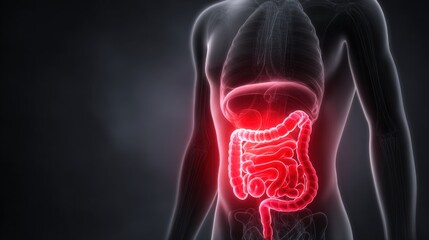Human body with inflamed stomach, intestines. Gastritis illustration showing pain, nausea, digestive disorder. Health condition, medical diagnosis, gastric inflammation.