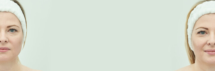 Caucasian mature female with headband showing half face on pastel background.